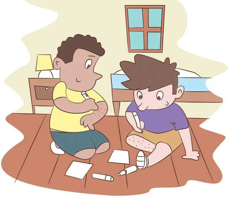 Two boys sit on a bedroom floor drawing red dots on their arms and legs with markers to pretend they are sick.